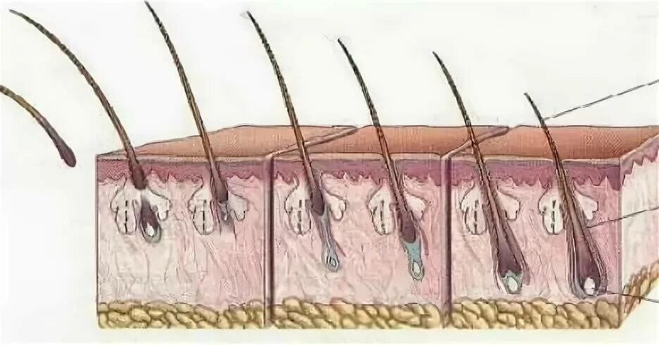 Растут корни волос. Волосяная луковица. Волос с волосяной луковицей. Выдернул волос с луковицей. Как выглядит волосяная луковица.