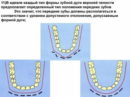 Зубные дуги верхней и нижней челюстей