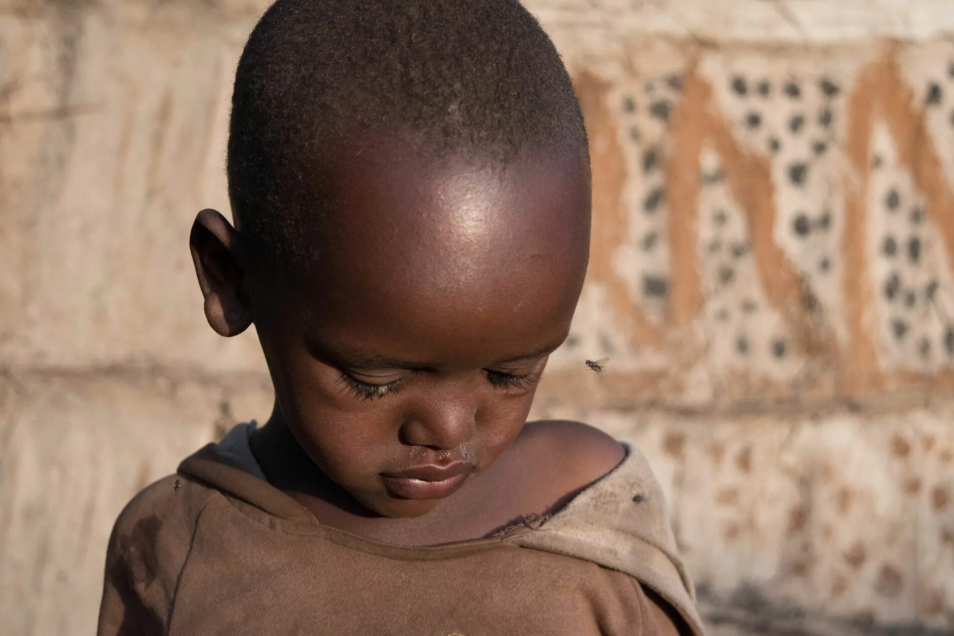 Children are ill disease in africa. Children are ill disease in africa. Children are ill disease in africa. Children are ill disease in africa. Либерия африка.