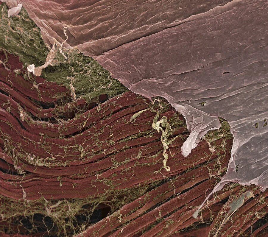 клетки мышечной ткани под микроскопом. гладкие мышцы под микроскопом. мышцы под микроскопом. микрофотография скелетной мышечной ткани. гладкая мышечная ткань гистология.