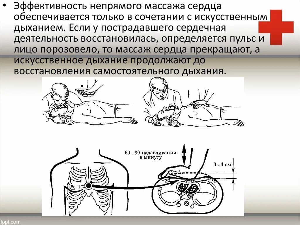 Реанимация непрямой массаж сердца и искусственное дыхание. Непрямой массаж сердца и искусственное дыхание техника выполнения. Оказание первой медицинской помощи непрямой массаж сердца. Соотношение непрям массажа сердца и искусственной вентиляции легких.