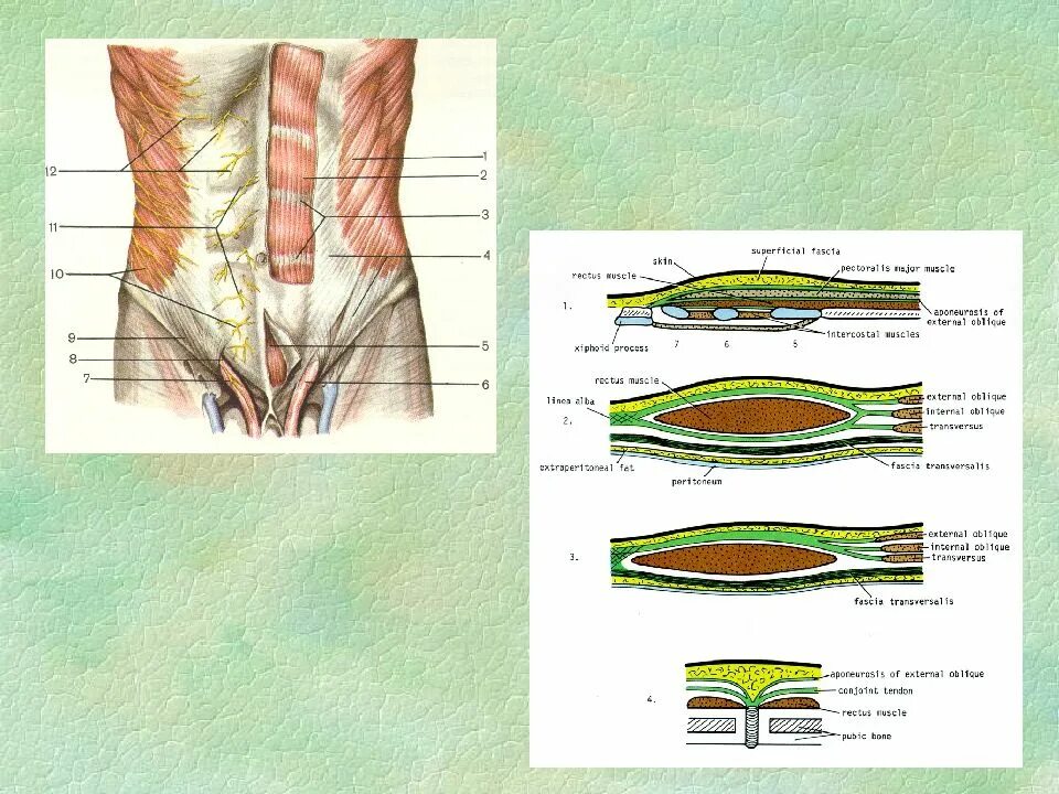 Стенка анатомия. Мышцы брюшной стенки топографическая анатомия. Передняя брюшная стенка топографическая анатомия грыжи. Передняя брюшная стенка послойное строение. Послойная анатомия передней брюшной стенки.