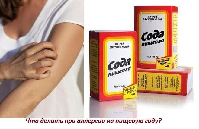 Как и чем лечить укусы комаров