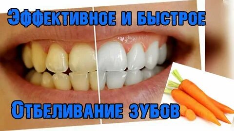 Отбелить желтые