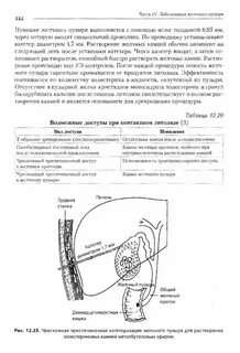 Стул желчного пузыря