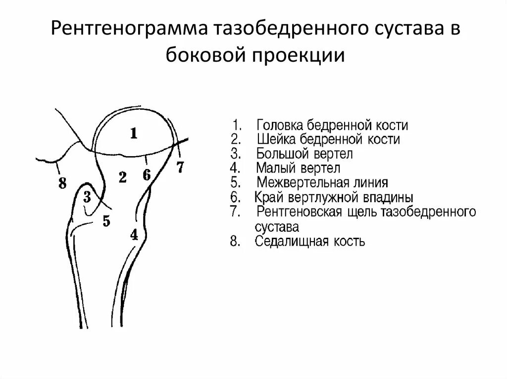 Тазобедренный сустав рентген анатомия. Рентгенограмма тазобедренного сустава в проекции Лауэнштейна. Рентген анатомия тазобедренных суставов норма. Рентгеноанатомия тазобедренного сустава.