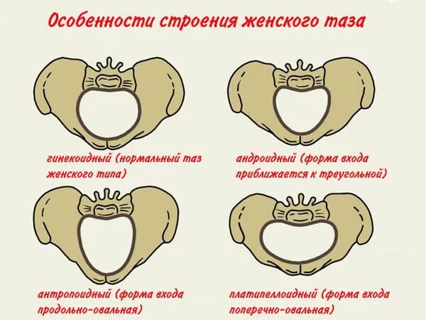 Кесарево узкий таз. Формы женского таза. Типы строения таза.