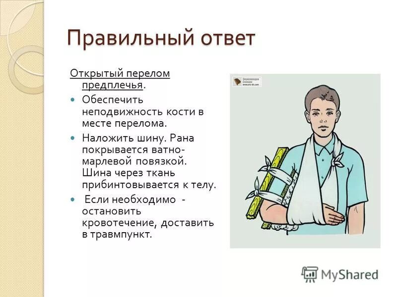 шина крамера при переломе костей предплечья. иммобилизация предплечья шиной крамера. техника наложения транспортной шины при переломе предплечья. как наложить шину при переломе предплечья. перелом предплечья наложение шины.