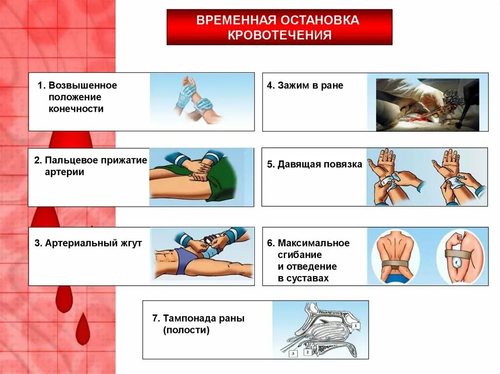 Остановка кровотечения. Временная остановка кровотечения. Способы временной остановки кровотечения. Методы остановки наружного кровотечения.