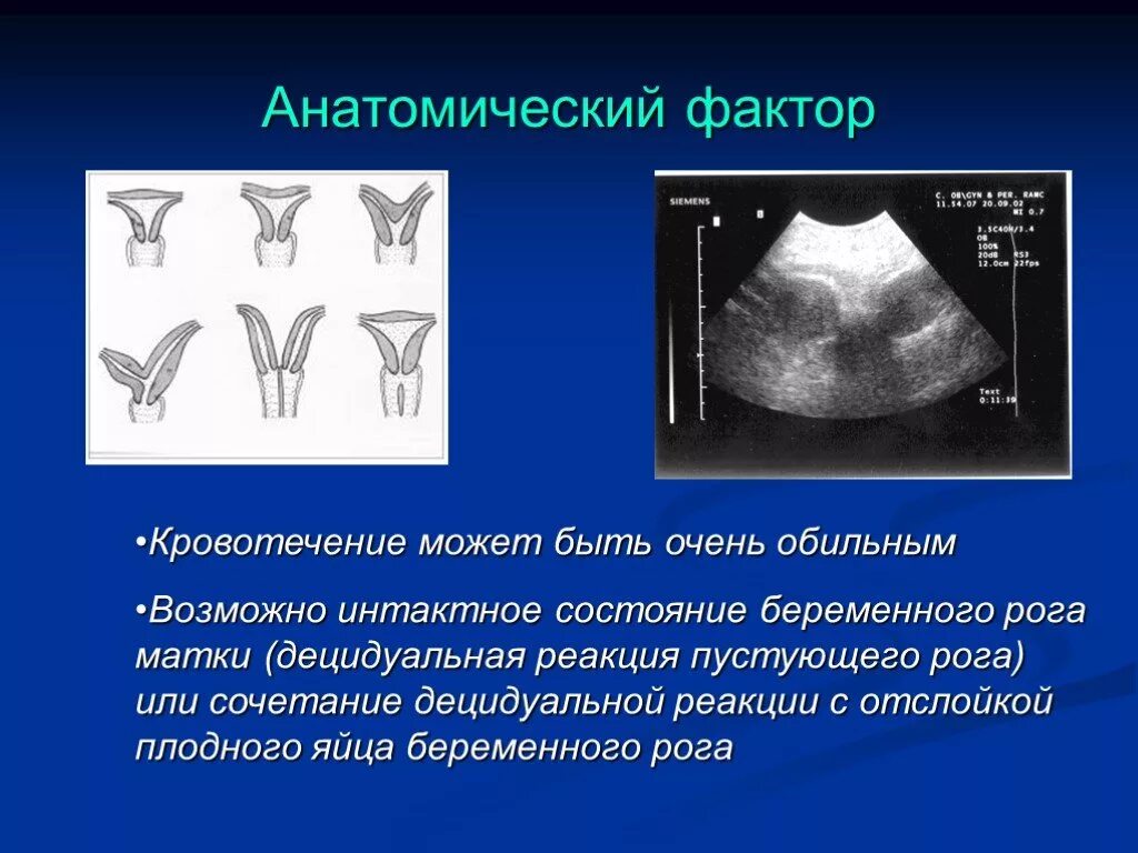 Анатомические факторы. Децидуальная реакция эндометрия. Децидуальная реакция матки. Децидуальная реакция при беременности что это.