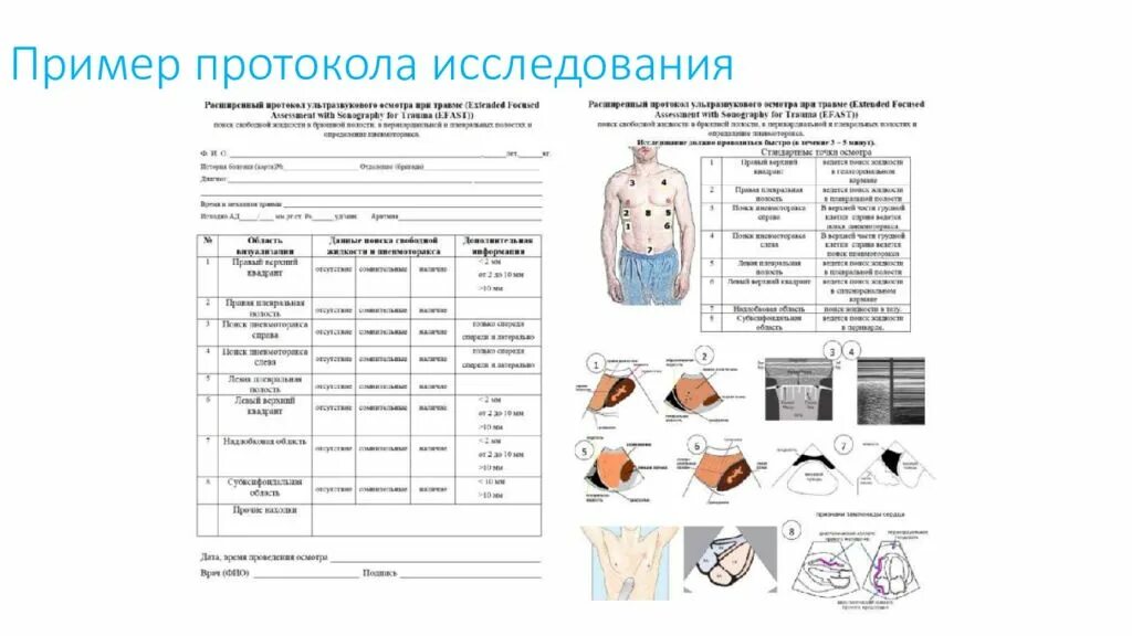 Протокол ультразвукового исследования EFAST. Фаст протокол УЗИ новорожденных. Fast протокол УЗИ при травме. Фаст протокол УЗИ сердца. Fast протокол