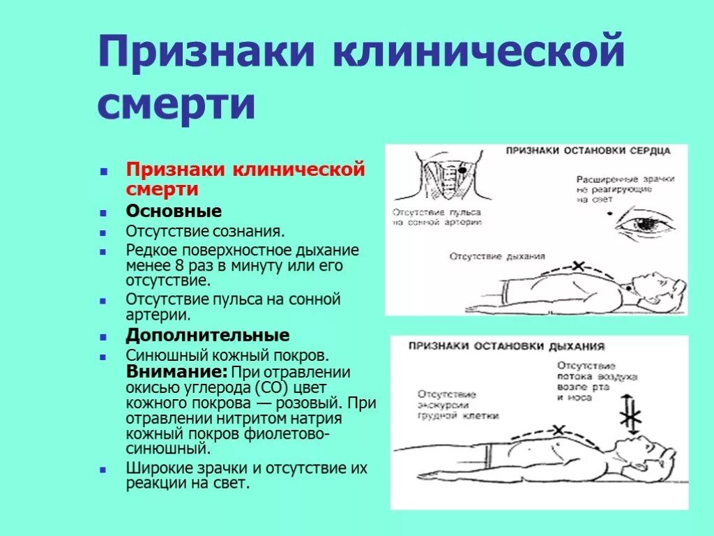 Характерные признаки клинической смерти. Достоверные признаки клинической смерти. При определении признаков клинической смерти необходимо:. 4. Перечислить признаки клинической смерти. Второстепенные симптомы клинической смерти.