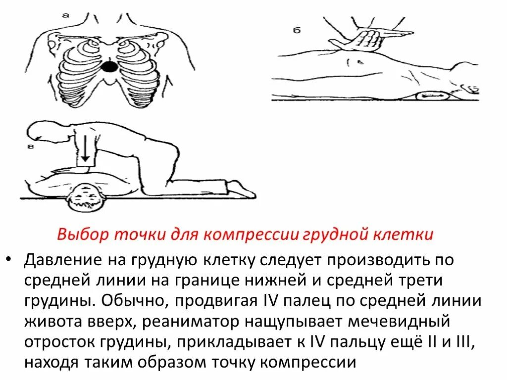 Определение точки компрессии при СЛР. Точка компрессии грудной клетки. Точка компрессии грудной клетки при сердечно легочной реанимации. Сжатие груди