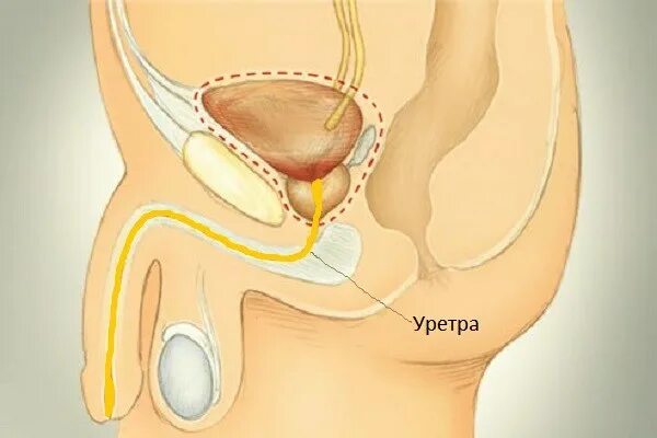 Канал мочи у мужчин