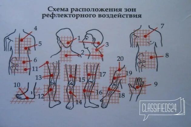 Зоны захарьина-геда схема. Зоны рефлекторного воздействия. Сосудистые рефлексогенные зоны. Рефлекс черниговского. Рефлекторные точки на стопе.