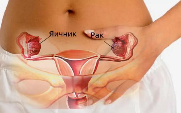 как расположены яичники у женщин.