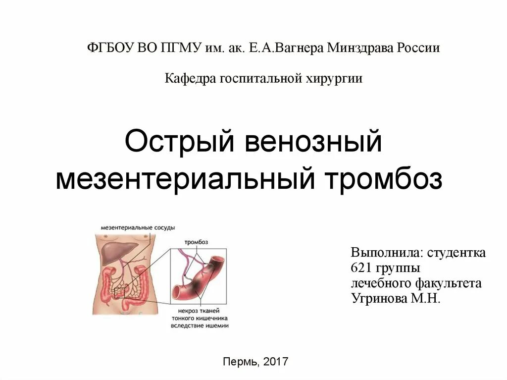 Мезентериальный тромбоз мкб. Тромбоз мезентериальные сосуды. Мезентериальный тромбоз патогенез. Острый мезентериальный тромбоз. Венозный мезентериальный тромбоз.