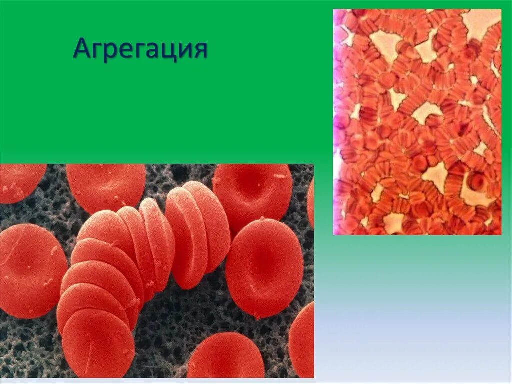 Агрегация эритроцитов это. Агрегация. агрегация это в биологии. агрегация картинки. агрегация это в медицине.