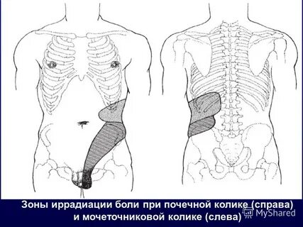 Почки отдают в ребра