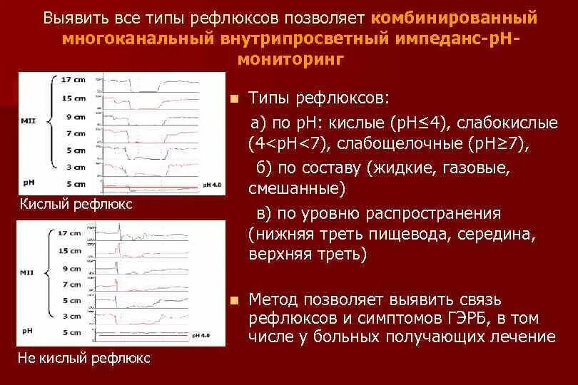 Устройство, регистрирующее уровень рефлюкса. Шкала для диагностики ларингофарингиално эзофагального рефлюкса. Эндовезикальная коррекция рефлюкса схема. Рефлюкс СФС скорость. Тест рефлюкса