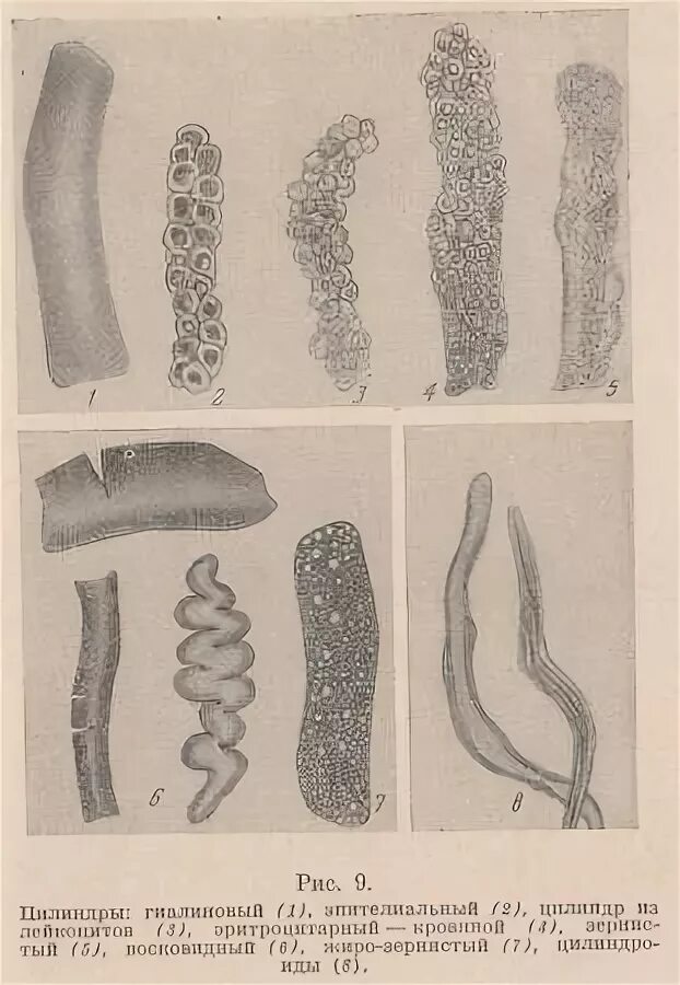 Цилиндр эпителий. Цилиндр эпителий. Однослойный столбчатый эпителий. Цилиндр эпителий. Гиалиновый цилиндр под микроскопом.