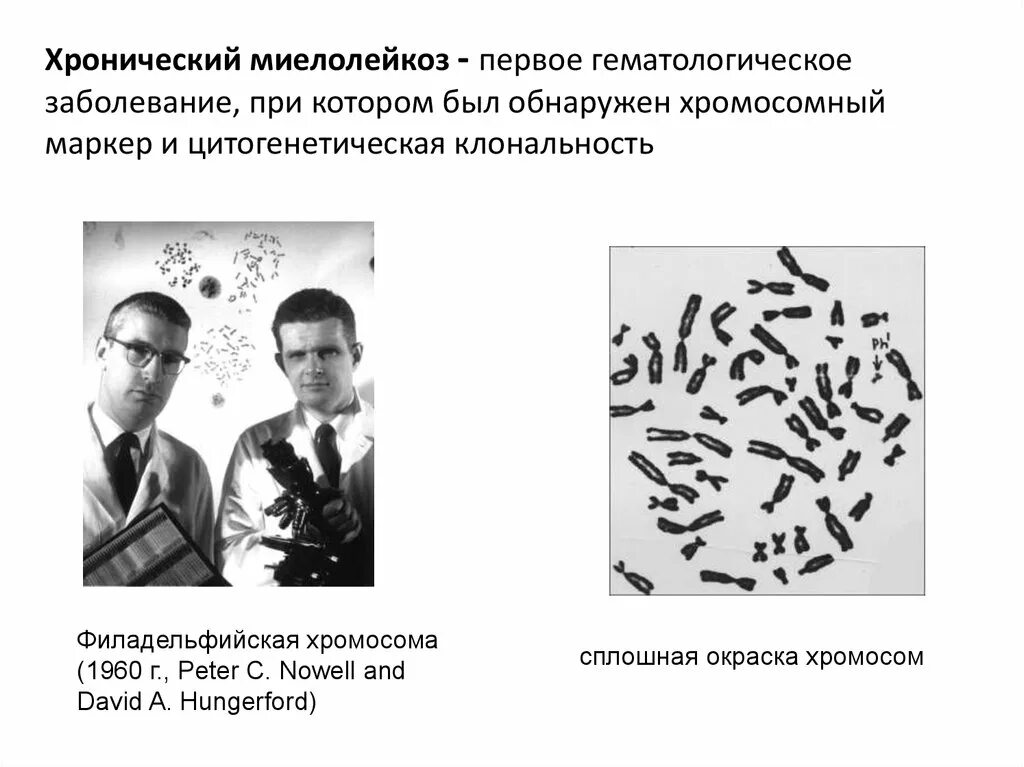 Изменение окраски хромосом. Сплошная окраска хромосом. Дифференциальное окрашивание хромосом. Филадельфийская хромосома лейкоз. Цитогенетическая диагностика острых лейкозов.