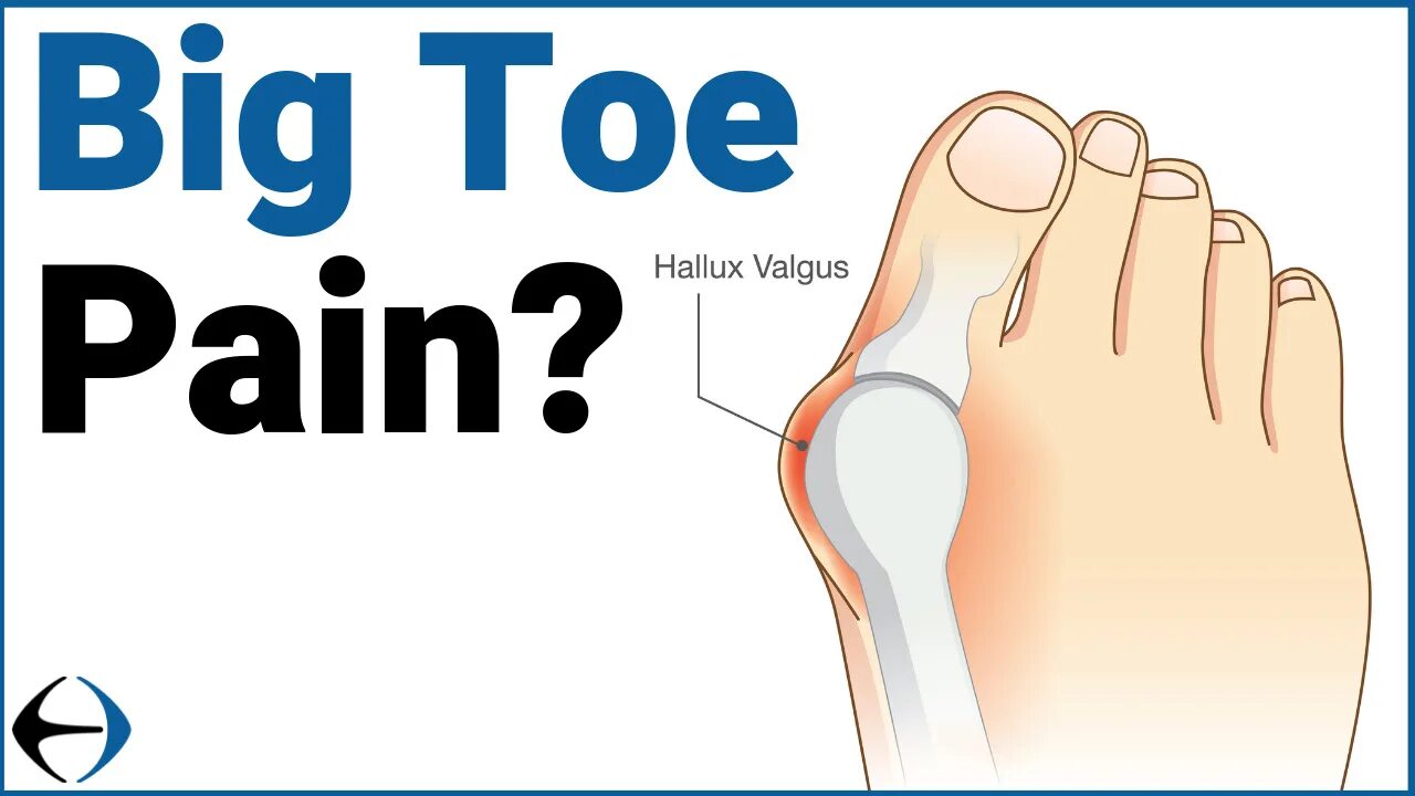 Big toe. Toes перевод. tip toe. big pains. big toe up.