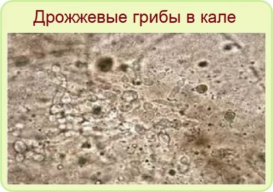 Грибы в копрограмме у взрослого. Микроскопия кала дрожжевые грибки. Дрожжи в Кале микроскопия. Микроскопия кала споры грибов. Дрожжевые грибы в Кале микроскопия.