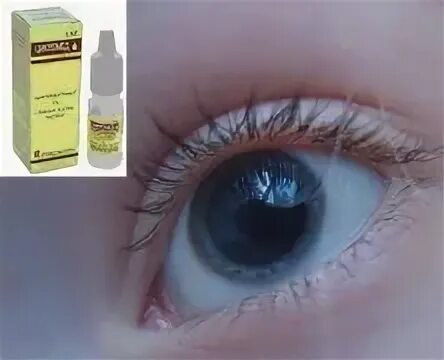 Как уменьшить зрачки капли