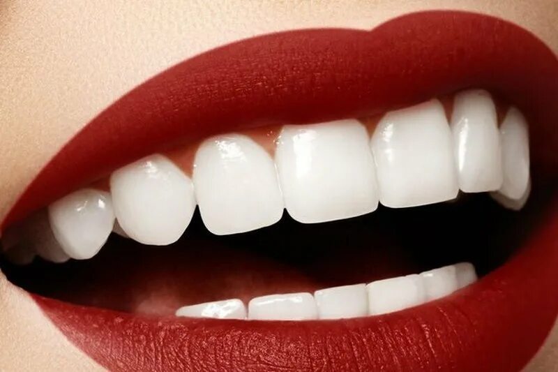 Красивые зубы. Идеальные зубы. Красивые зубы. Ровные белые зубы. Здоровые зубы красивая улыбка.