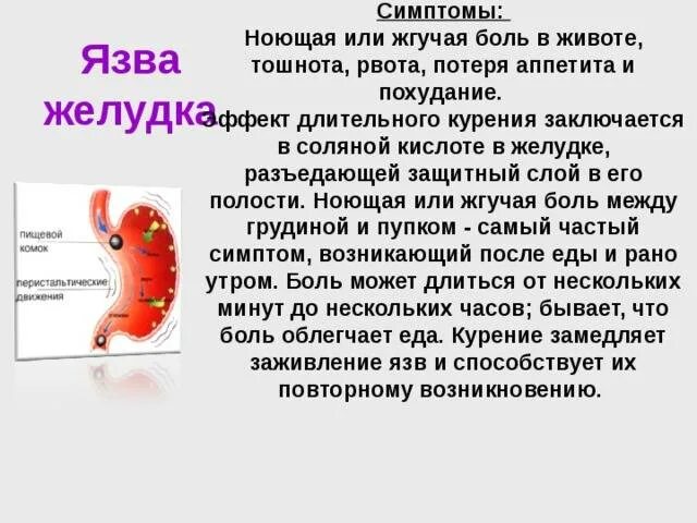 Какой желудок болит. Боль и дискомфорт в желудке. болит желудок после еды. боль в желудке после еды.
