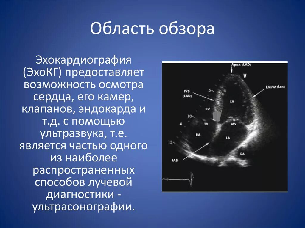 Области обзор. ЭКГ И ЭХОКГ. Эхокардиография ЭКГ. Возможности ЭХОКГ. ЭХОКГ И ЭКГ разница.