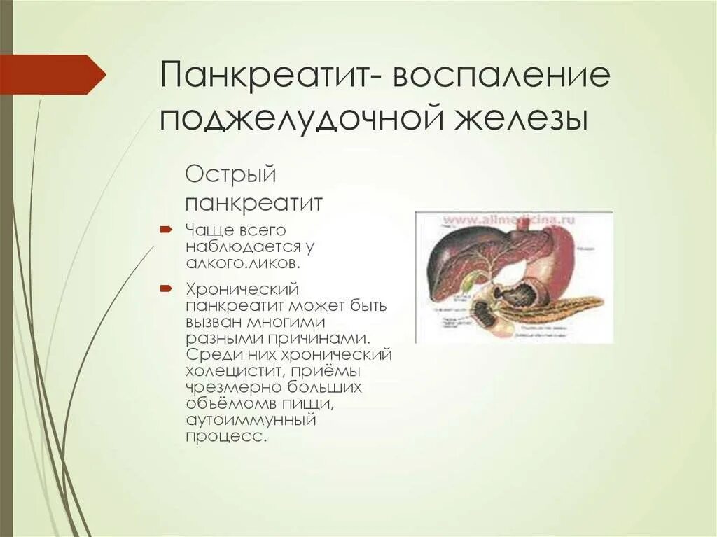 Панкреатит и панкреонекроз. Снятие воспаления поджелудочной. Лекарство от панкреатита поджелудочной железы. При воспалении поджелудочной железы. Продукты для снятия воспаления поджелудочной.