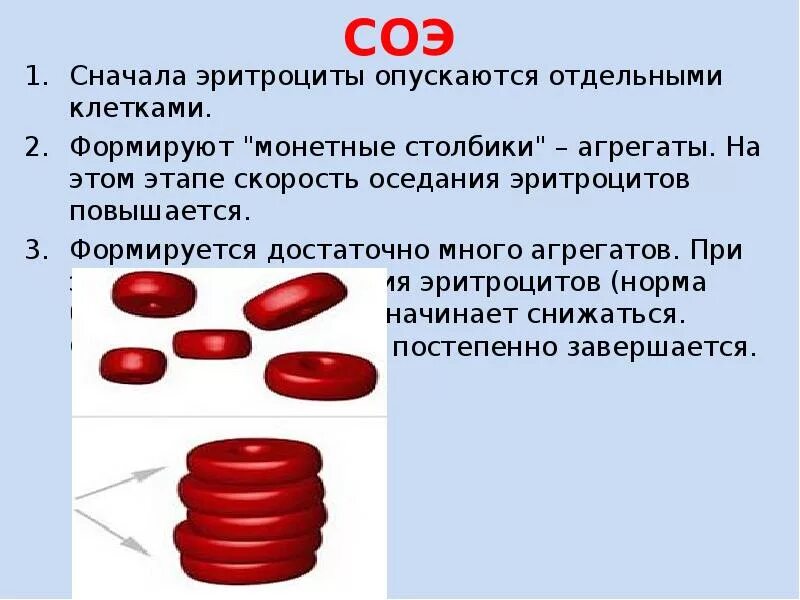 Причина оседания эритроцитов. Монетные столбики эритроцитов причины. агрегация эритроцитов в виде монетных столбиков это. монетные столбики - слипшиеся эритроциты. образование монетных столбиков эритроцитов.