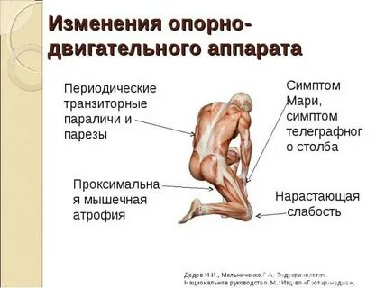 Нарастающая слабость