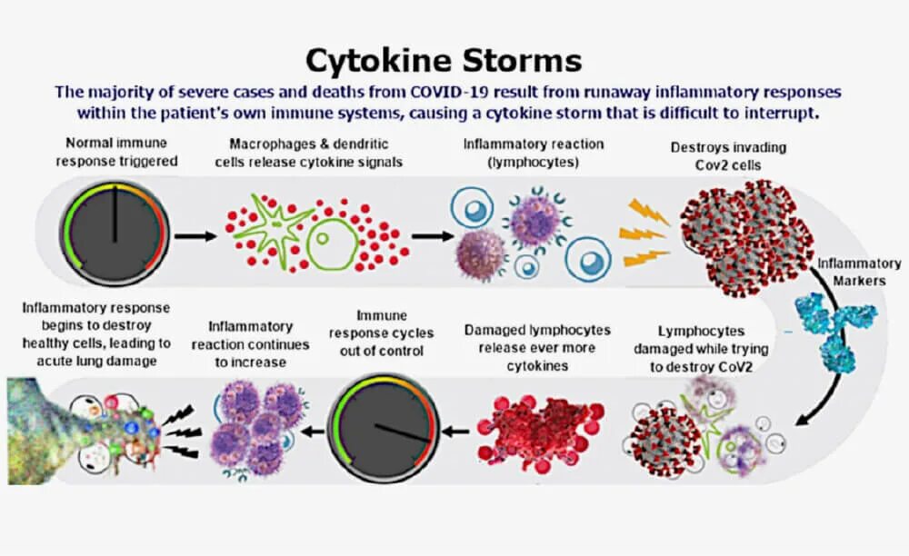 Цитокиновый шторм ковид. Цитокиновый шторм механизм развития. Цитокиновый шторм схема. Патогенез коронавирусной инфекции цитокиновый шторм. Коронавирус ковид 19
