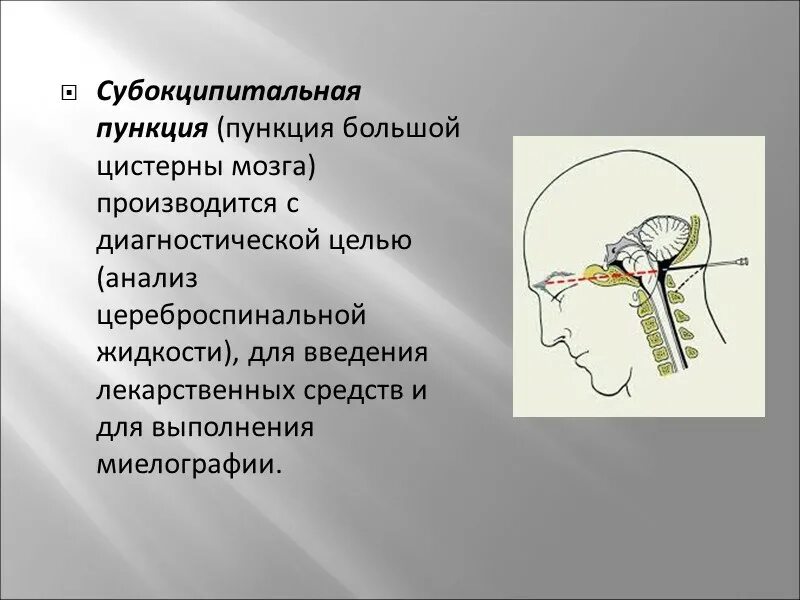 Как берут пункцию мозга. Цистернальная пункция. Субокципитальная пункция показания. Пункция мозжечково-мозговой цистерны. Субокципитальная пункция ликвора.