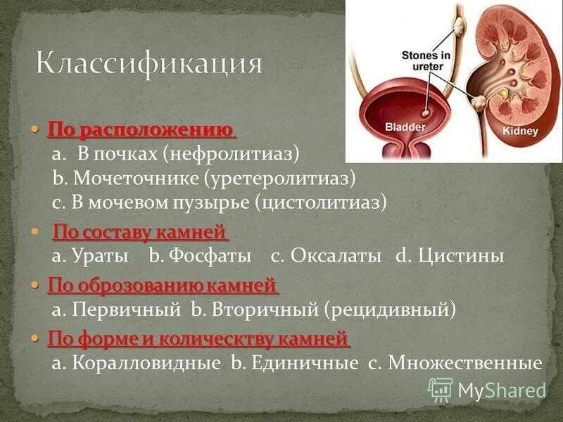 Обструкция мочеточника. Заболевания мочевыделительной системы мочекаменная болезнь. Мочекаменная болезнь (нефролитиаз). Классификация конкрементов почек. Образование камней в мочевыделительной системе.