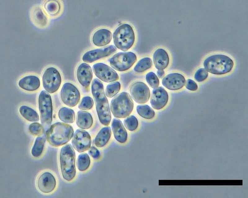 Оборудование для изучения клеток дрожжевых грибов. Клетки дрожжей под микроскопом. Микропрепарат клеток дрожжей. Дрожжеподобные клетки в микроскопе. Клетка дрожжей в микроскопе.