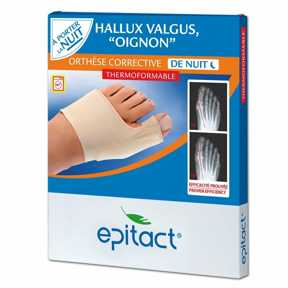 Epitact. Халлюкс вальгус степени. Hallux valgus что это