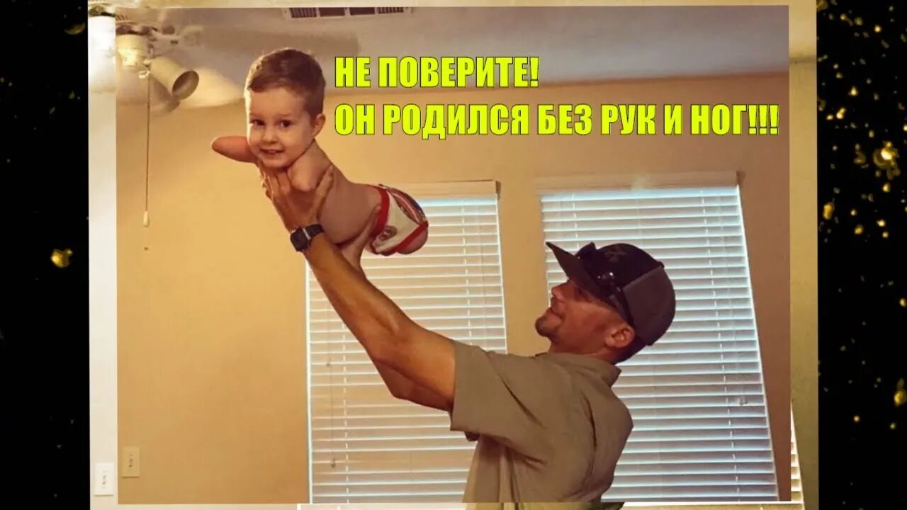 Родился без руки. Мальчик родился без рук и ног.