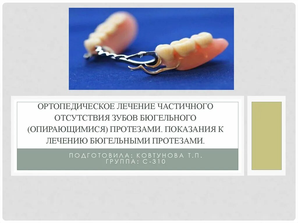 Преимущества и недостатки бюгельных протезов. Преимущества и недостатки бюгельных протезов