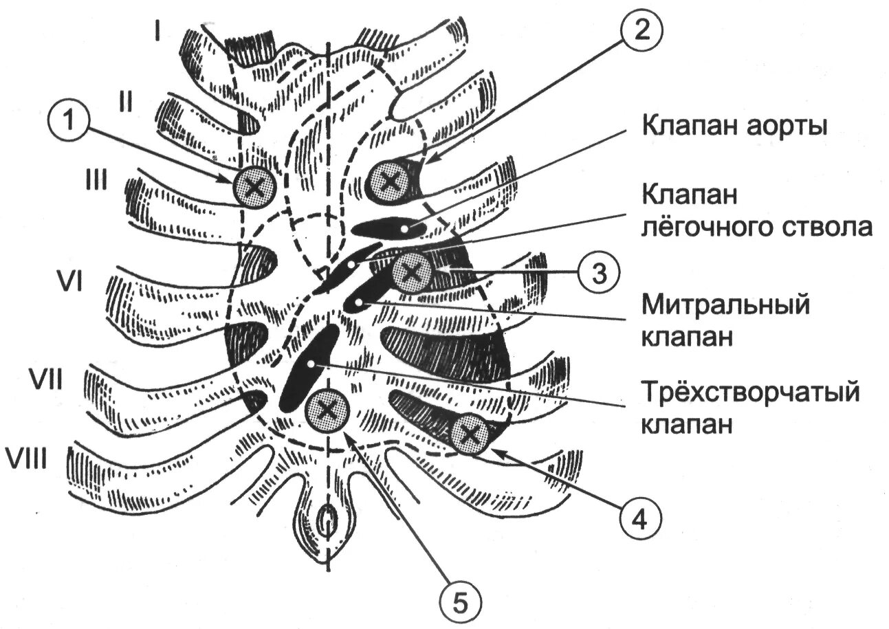 Тоны сердца точки выслушивания клапанов. Проекции и точки аускультации клапанов сердца. Места проекции клапанов на грудную клетку. Точки аускультации тоны схема. Клапаны сердца на грудной клетке