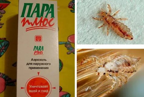 Самое эффективное средство от гнид и вшей
