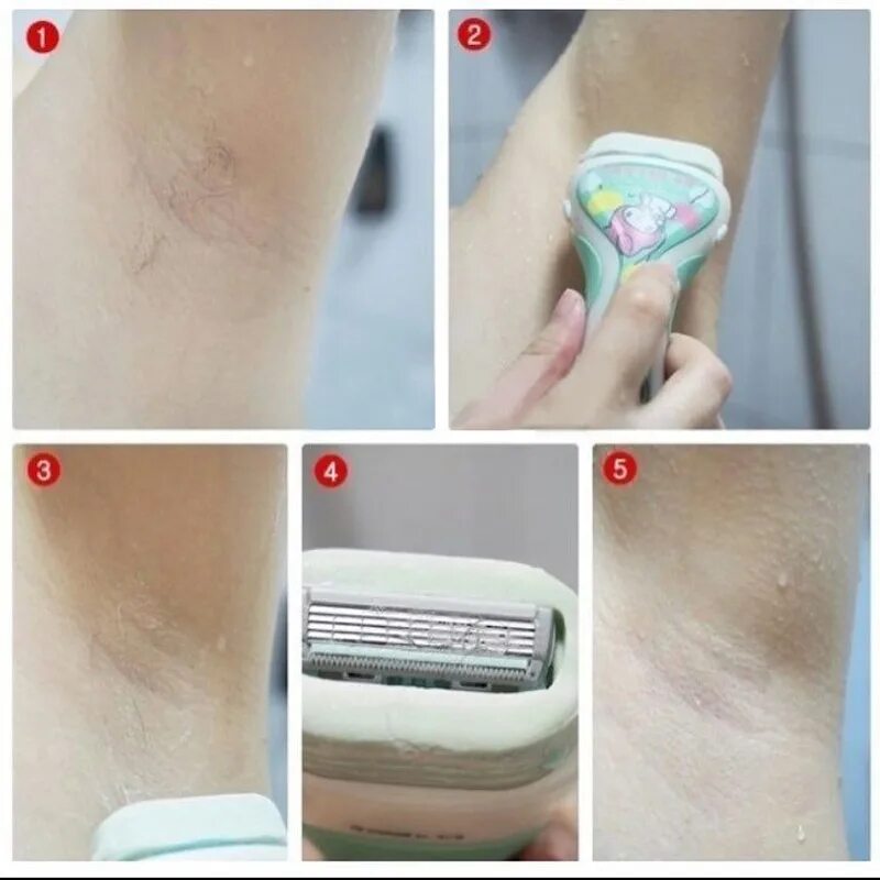 Фотоэпилятор как пользоваться