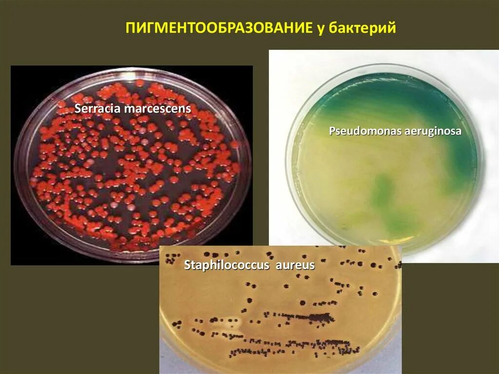 Накопление водорастворимых пигментов. Пигменты бактерий Serratia marcescens. Pseudomonas aeruginosa, Serratia marcescens.. Пигментообразование у бактерий. Пигментообразование микробиология.