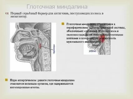 Небная миндалина мрт