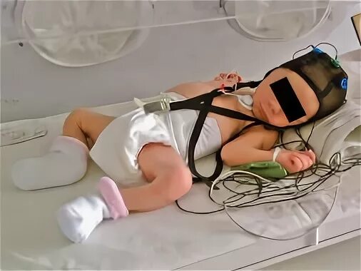 Ээга 21. ЭЭГ видеомониторинг. ЭЭГ У новорожденных. ЭЭГ видеомониторинг сна. ЭЭГ видеомониторинг детское.