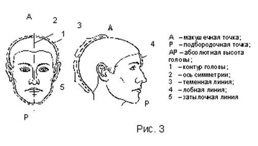 Где у человека лоб. Форма теменной части криминалистика. Форма теменной части головы. Форма черепа криминалистика. Части головы криминалистика.