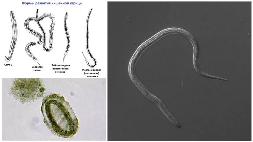 Жизненный цикл угрицы. Стронгилоидоз strongyloides stercoralis. Стронгилоидоз (кишечная угрица). Нематод strongyloides stercoralis. Кишечная угрица возбудитель.